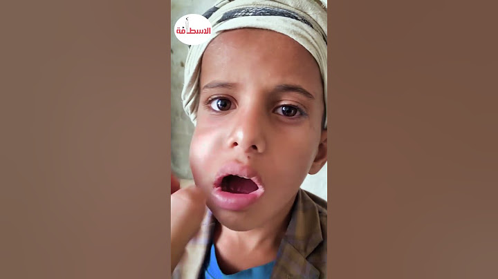 ما هوه نبات القات الأكثر انتشاراً في اليمن