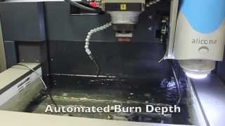 Automated Burn Depth