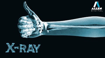 X- Rays | Physics | Recorded | ALLEN Digital