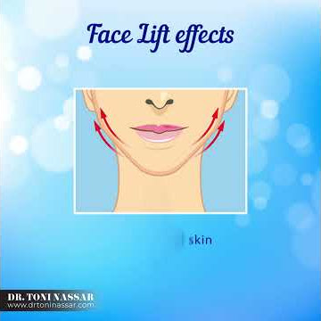 Facelift, is a surgical procedure required to correct sagging facial skin