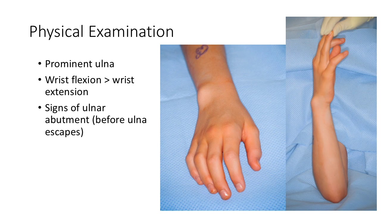 Congenital Differences — 