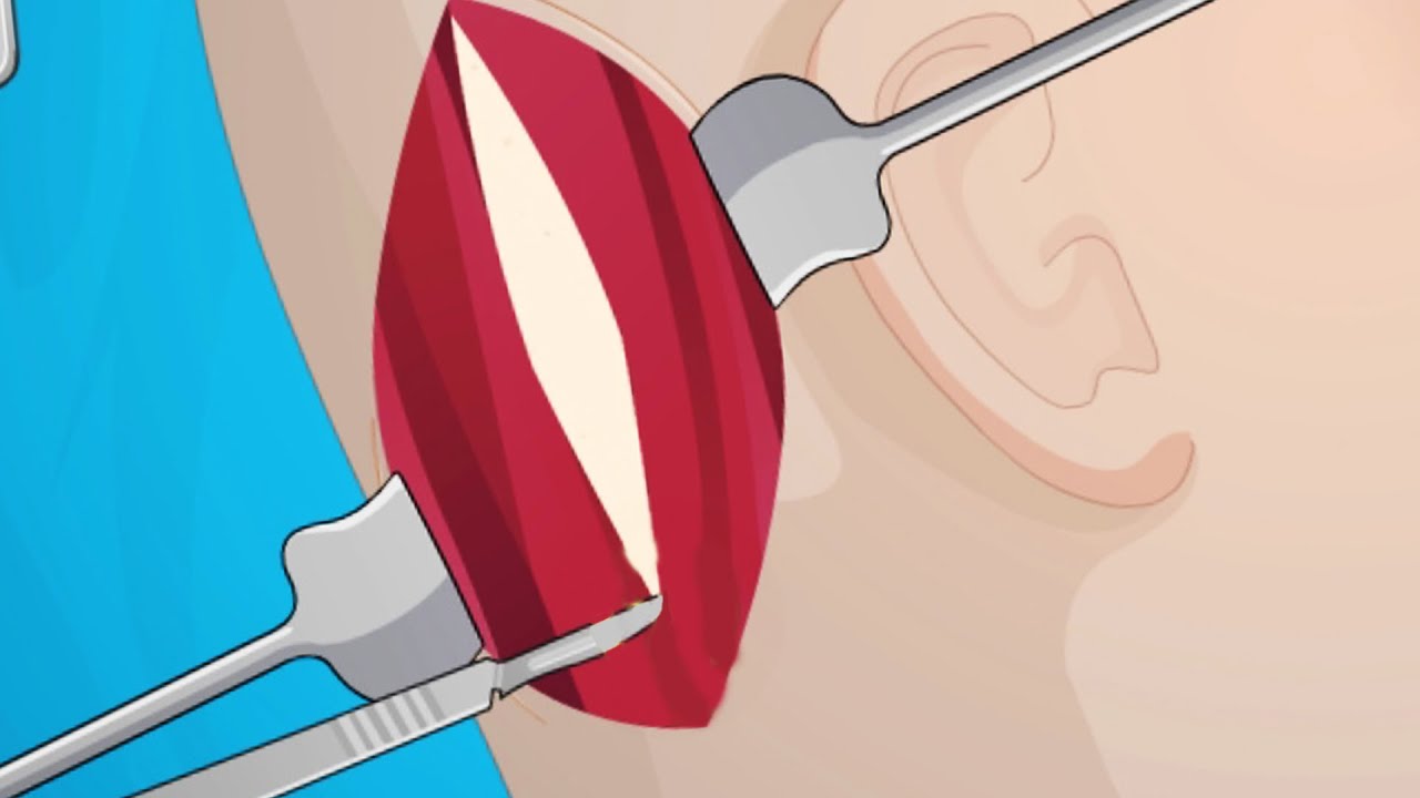Ear Surgery - (Flash Game)
