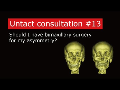 Should I have bimaxillary surgery for my asymmetry?