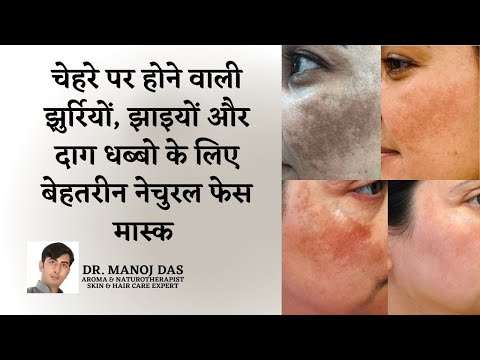 How To Get Rid of Hyper pigmentation I Freckles, Dark Spots, Melasma, Fast Naturally I DR. MANOJ DAS