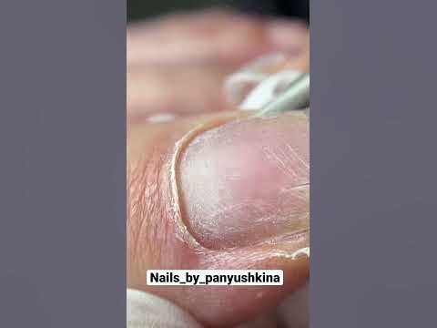 Обработка кутикулы#ногти #аппаратныйпедикюр #педикюр #подология # ...