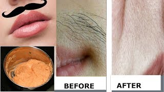 In this video, i am showing you how to remove unwanted hairs
permanently at home. it's a natural way of hair removal. it not only
removes but also brig...