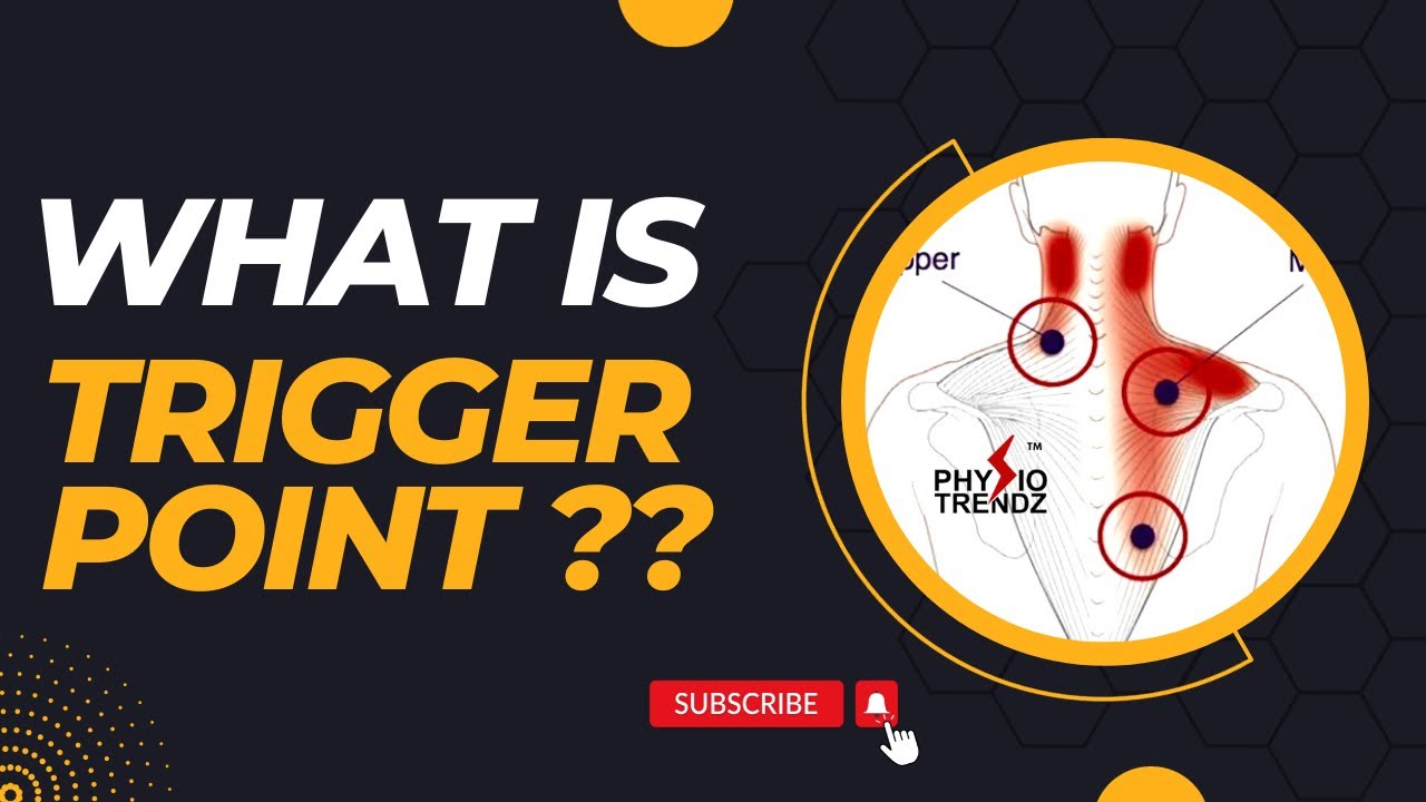 What is trigger point? - YouTube