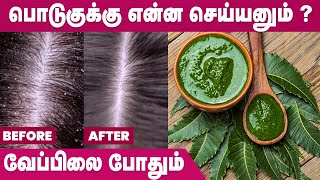 பொடுகை சரி செய்ய வீட்டு வைத்தியம் | Dandruff Treatment at Home in Tamil | IBC Mangai