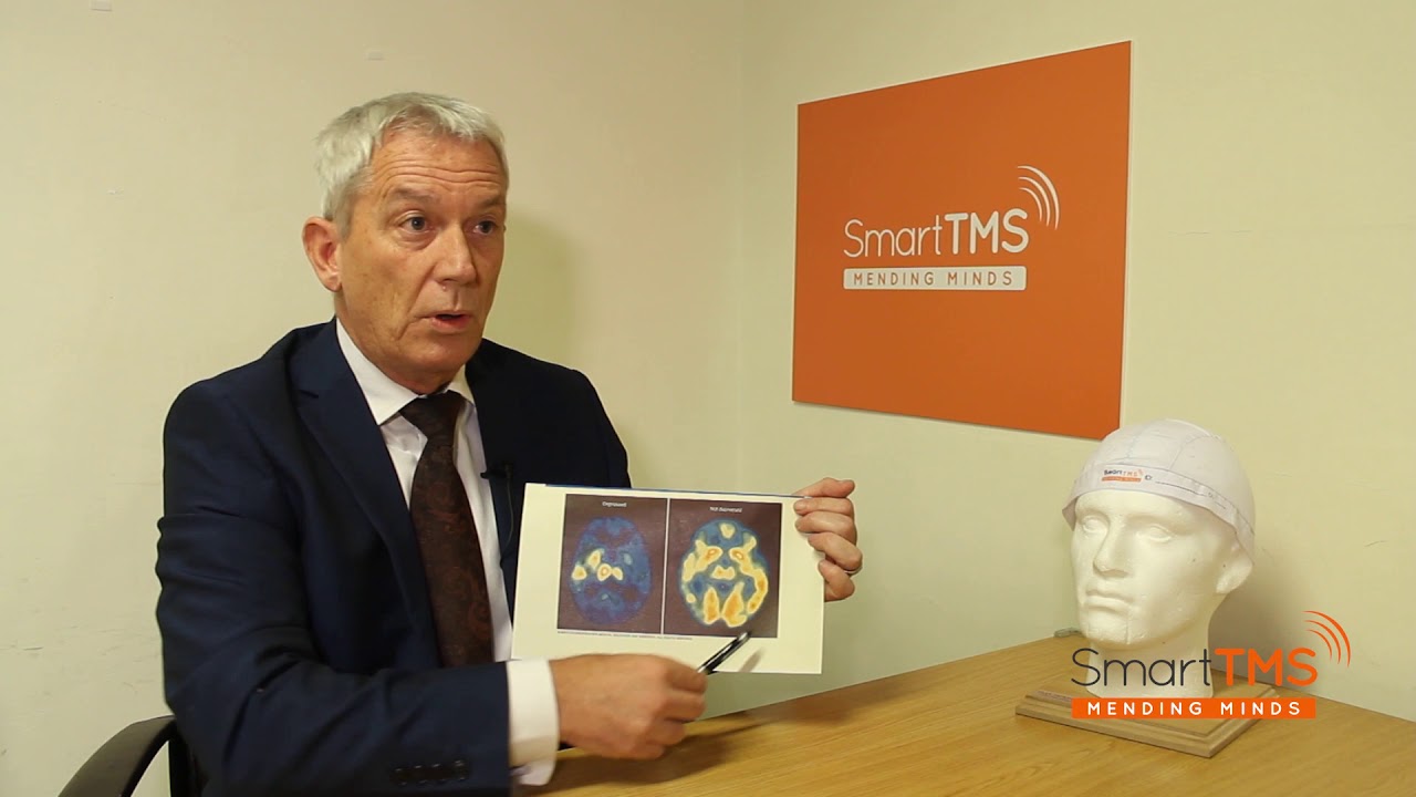 Which areas of the brain does TMS target for depression? - YouTube