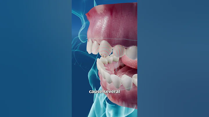 Opening Bottles With Your Teeth 😬