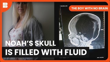 The Scan That Changed Everything | The Boy With No Brain | Medical Documentary