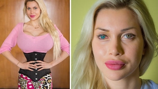 10 Craziest Stories Of Plastic Surgery Obsessions