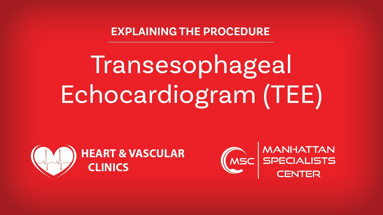 Transesophageal Echocardiogram (TEE): Patient Monitoring & Management -  Video & Lesson Transcript