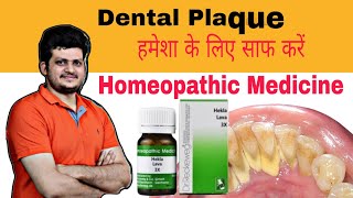 Dental Plaque हमेशा के लिए साफ करें | Homeopathic Medicine Hekla Lava ? screenshot 2