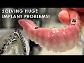 Solving Huge Implant Problems