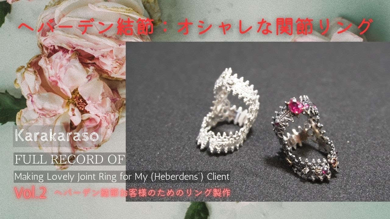 ヘバーデンリングヘバループ3セット ヘバーデン スプリント | 製品情報