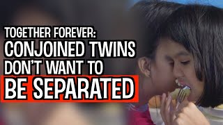 Conjoined Twins: Sisters Learn To Live In Harmony