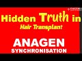 Hidden truth of hair transplant anagen synchronisation is an unknown phenomenon to many people
