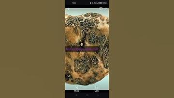 Plant Disease Detection using Machine Learning | Android App Projects for Final Year