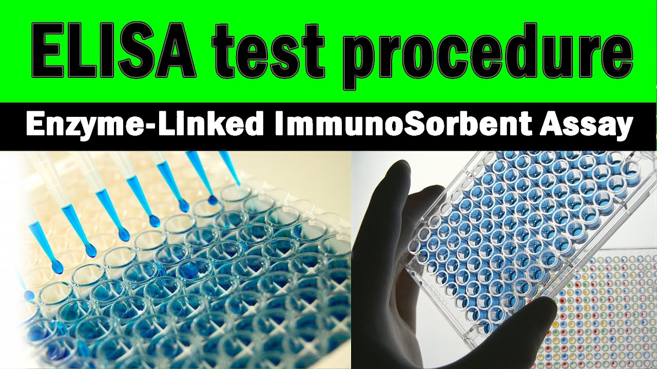 ELISA Test Procedure Enzyme Linked Immunosorbent Assay step By Step 