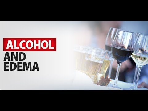 Alcohol and Edema