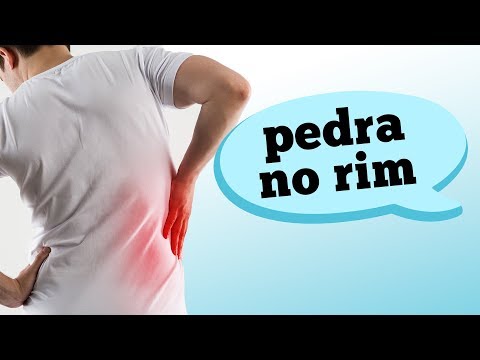 COMO DIFERENCIAR PEDRA NO RIM DE DOR NAS COSTAS?