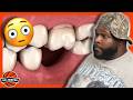 Frank Litto on How He Lost His Tooth & Being Clean off Drugs for 1 Year