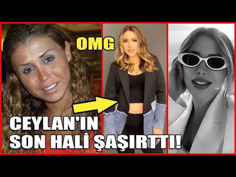 Ceylan'in Son Hali Şaşırttı! İşte Ceylan'ın Büyük Değişimi!