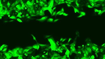 U-2 OS wound healing assay 100 hrs using JuLI FL