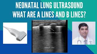 A and B lines on lung ultrasound in neonates. Dr Pradeep Suryawanshi #pocus #lungultrasound