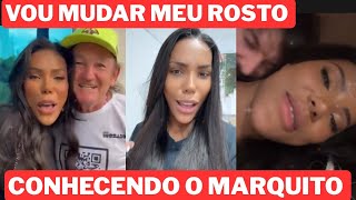 Carol Lekker Conhece O Marquito E Faz Procedimentos Estéticos No Rosto