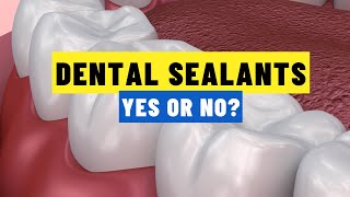 What’s REALLY In Your Child’s Sealants? Watch Before You Say Yes!