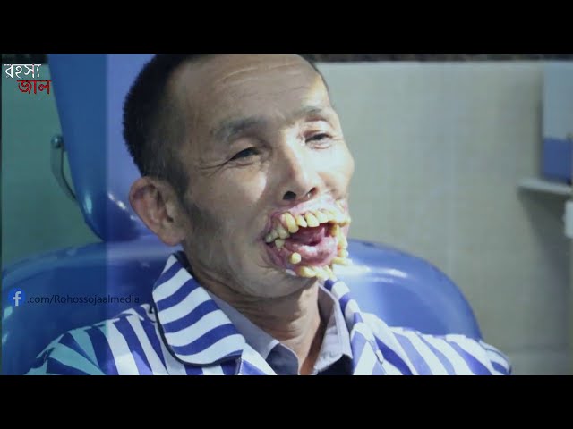 মানুষের দাঁতের সাথে ঘটা কিছু ভয়ানক ঘটনা, দেখলে আপনিও অবাক হতে বাধ্য | Rohossojaal