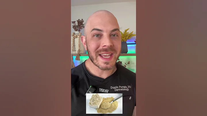 These foods could trigger your rosacea! #dermeducates #doctoreducates #rosacea