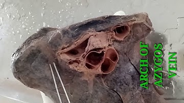 LUNGS PART-2 - ROOT AND RELATIONS - BY DR MITESH DAVE