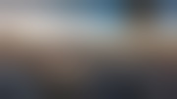 Bypass for Complex Aneurysm