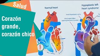 Los pequeños corazón? es vasos de enfermedad la ¿Qué del