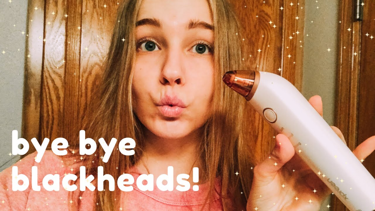 do pore vacuums ACTUALLY work?! Removing BLACKHEADS! YouTube