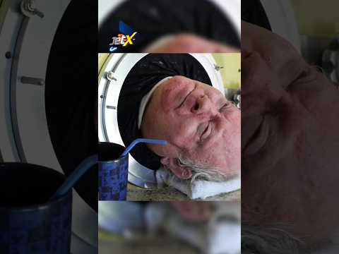 Мужчина провёл всю жизнь в барокамере: человек и полиомиелит