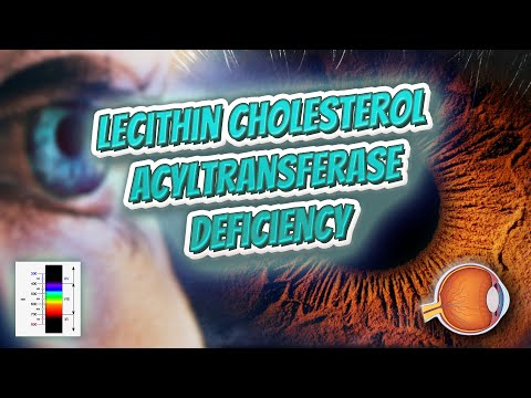 Video: Identifisering Og Funksjonell Analyse Av Missense-mutasjoner I Lecithin Cholesterol Acyltransferase Genet Hos En Chilensk Pasient Med Hypoalphalipoproteinemia