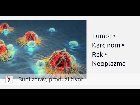 Video: Tumor Kičme (ili Repa) I Rak Hrskavice U Ferata