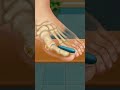 Hard surgery animation 👍#youtubeshort #shortvideo