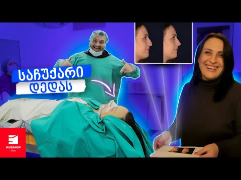 ცხვირის ოპერაცია კუზანოვის კლინიკაში (რინოპლასტიკა)