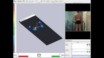 Postural Assessment through High-Tech Machine.