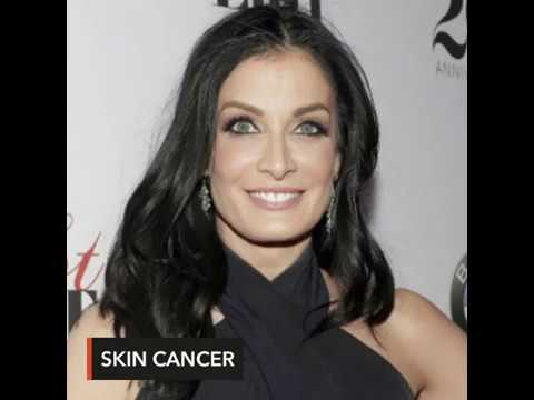 Video: After Being Diagnosed With Skin Cancer, Dayanara Torres Opens Up About Her Health And Life Today