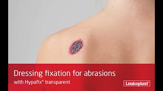 Learn how to size and apply Hypafix Transparent dressing to abrasions