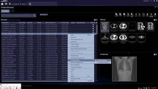 Patient Browser - SIEMENS CT SOMARIS X or 10شرح السوفت وير الأشعه المقطعيه سيمنس screenshot 5