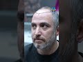 🌟 Hair Transplant: Real Experience 🌟 #hophealth #healthtourism #healthassistant