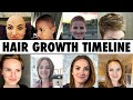 Post Chemo HAIR GROWTH (What to EXPECT)