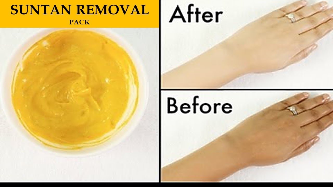 Magical Mask To Remove Sun Tan Instantly From Face Body Sun Tan magical-mask-to-remove-sun-tan-instantly-from-face-body-sun-tan